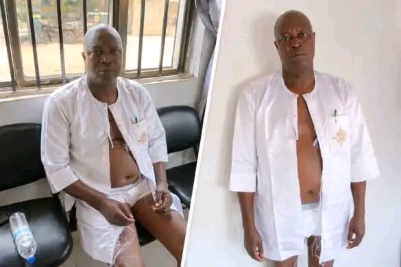 Ondo APC Crisis Deepens as Thugs Attack, Strip Party Chairman at Stakeholders’ Meeting